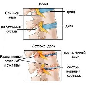 кружится голова и шум в ушах