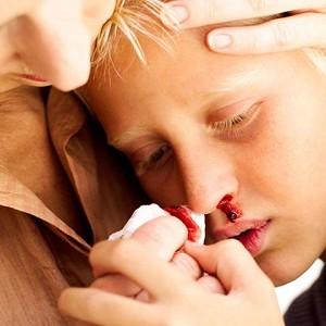 часто течет кровь из носа у ребенка