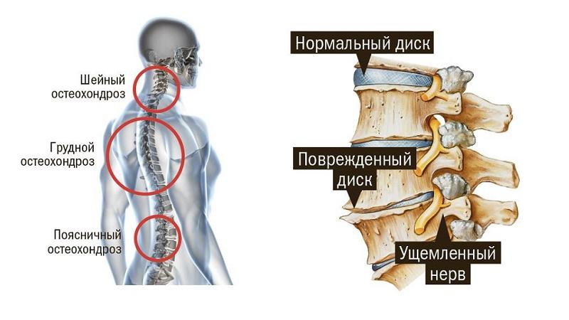 от чего закладывает уши и кружится голова