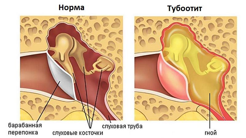 причины звона в ушах и голове