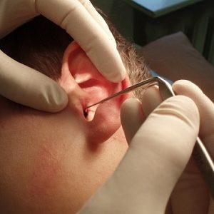 звон в ухе причины и лечение