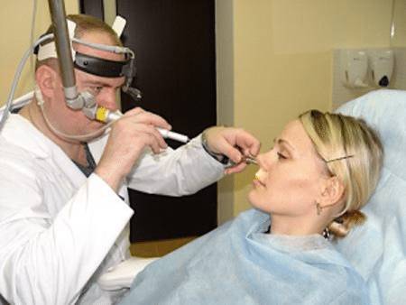 симптомы сломанного носа