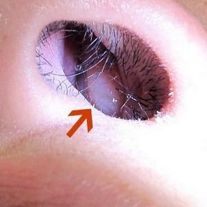 как часто промывать нос при гайморите