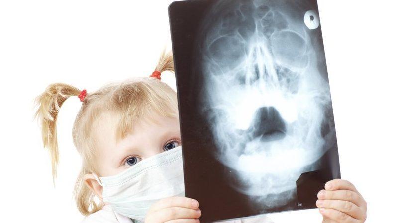 рентген пазух носа