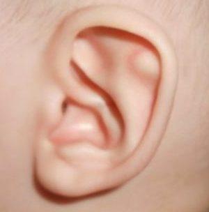 шишки в ушах