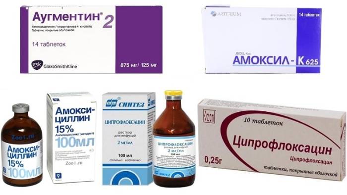 Как лечить ангину у ребенка