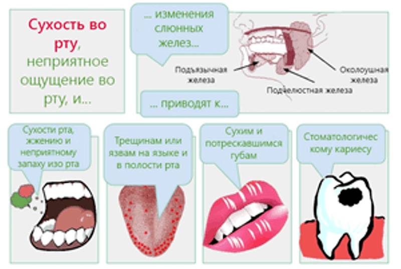 сухая слизистая