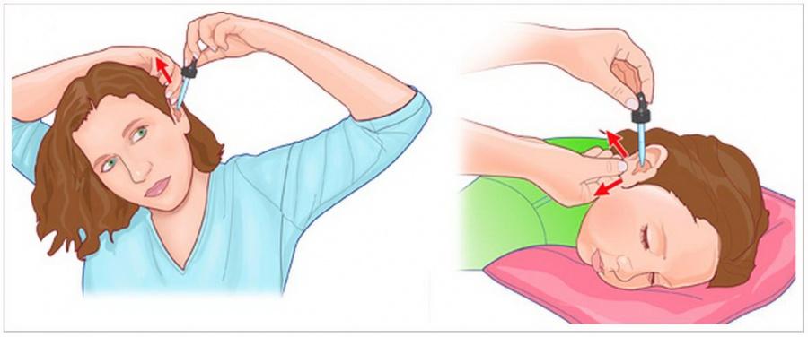 tsipromed-ushnye-kapli