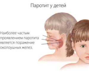 Что за шишка за ухом у ребенка