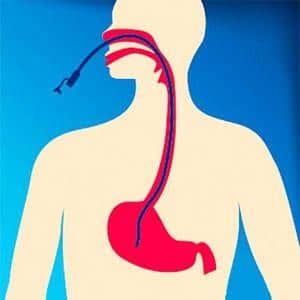 удаление гортани при злокачественной опухоли послеоперационный период