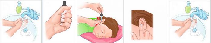 отипакс ушные капли инструкция по применению детям