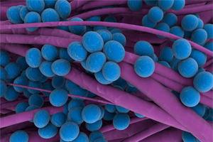 stafilokokk-v-ukhe-lecheniye