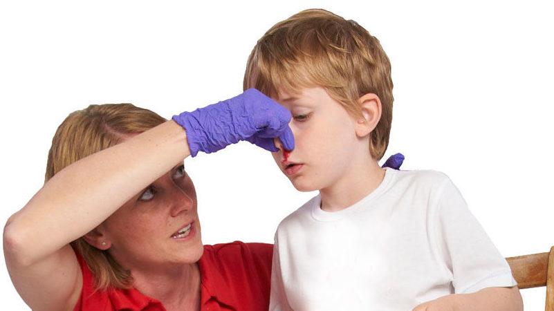 как отличить перелом носа от ушиба