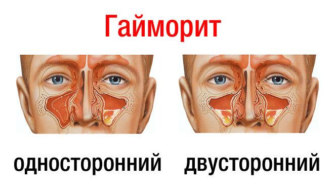 температуры нет