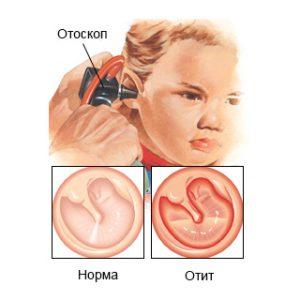 закладывает уши причины