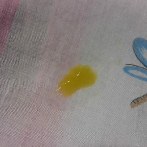 густые желтые сопли