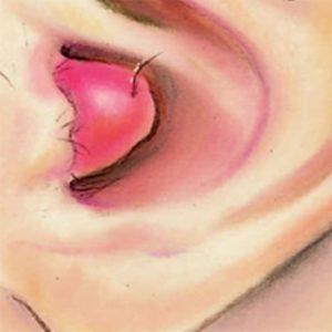 жидкость в ушах что это